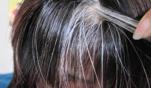 白发转黑发的养发技巧有哪些？