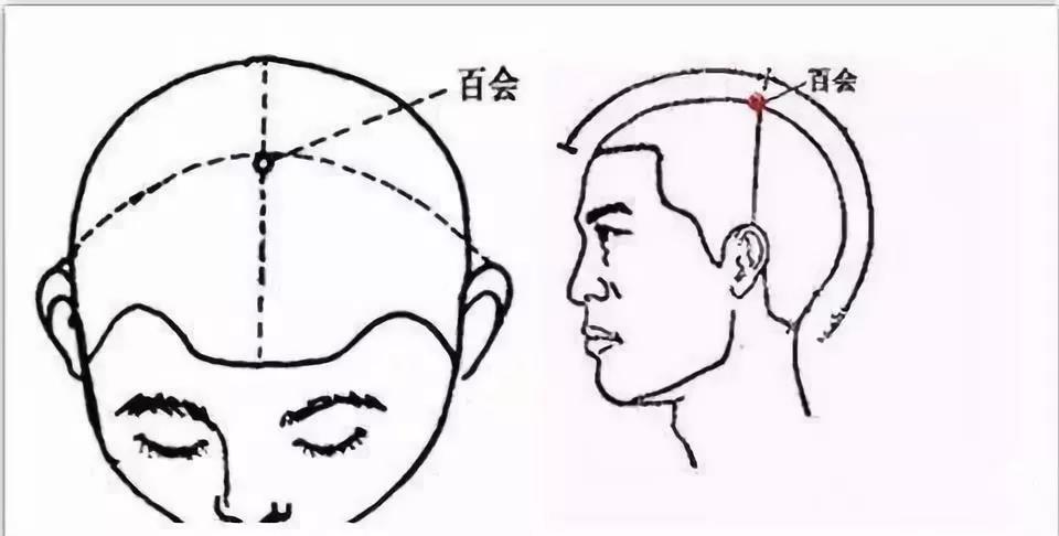 白发集中出现在头顶部位是肾气虚