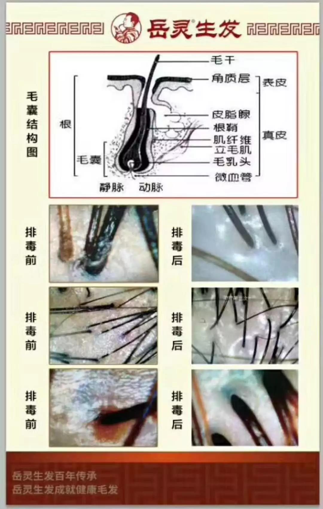 白发反复拔容易引发毛囊炎