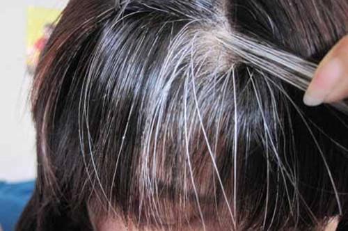 容易长白头发的人应该如何预防白发
