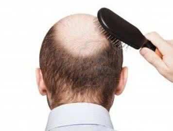 防脱生发的养发护理小技巧