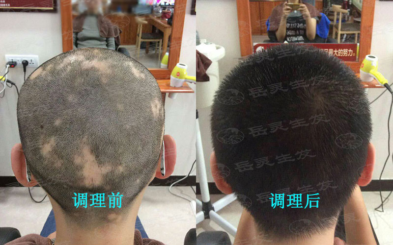 植物养发加盟哪个牌子好